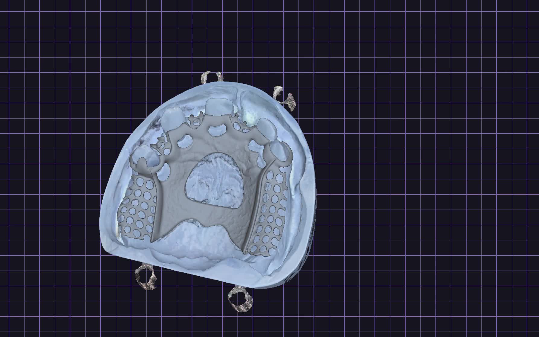 CAD prikaz gornje i donje čeljusti