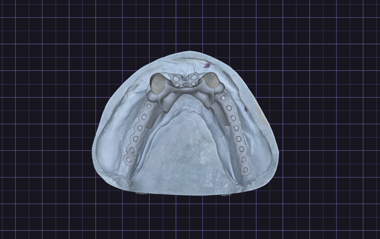 Parcijalni framework prikaz